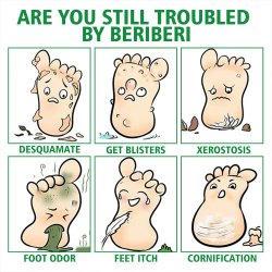 اسپری گیاهی ضدبو و درمان زخم پا حجم 30 میلی لیتر